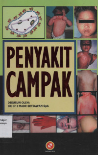 Penyakit Campak